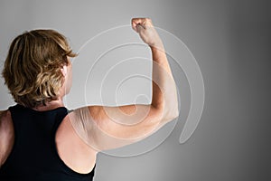 Overweight Lady Arm With Excess Fat