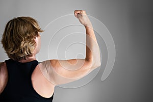 Overweight Lady Arm With Excess Fat photo