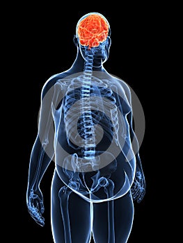 Overweight male - brain