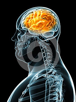 Overweight male - brain
