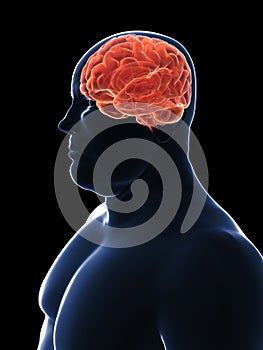 Overweight male - brain