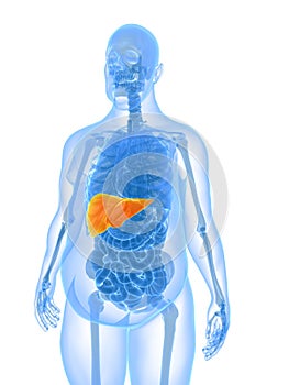 Overweight male - liver