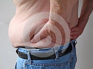 Overweight man with backache