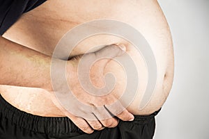 Overweight man body with hands touching belly fat