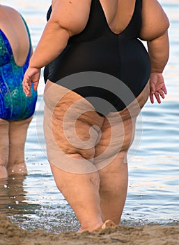 Overweight woman.