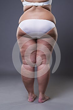 Overweight woman with fat legs and buttocks, obesity female body