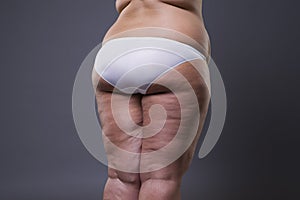 Overweight woman with fat legs and buttocks, obesity female body