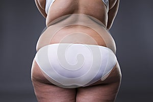 Overweight woman with fat legs and buttocks, obesity female body