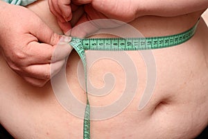 Overweight women stomach