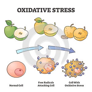 Oxidative stress aging as free radical cell attacking process outline diagram