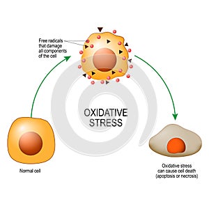 Oxidative stress. Vector diagram for your design, educational, science and medical use