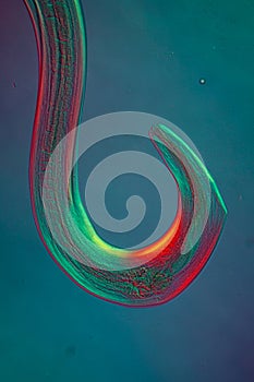 Oxiuris parasitic pinworm 100x