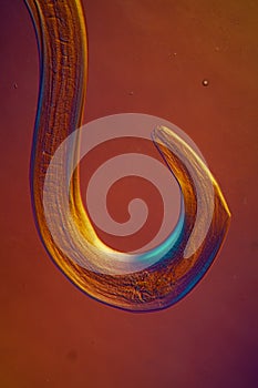 Oxiuris parasitic pinworm 100x