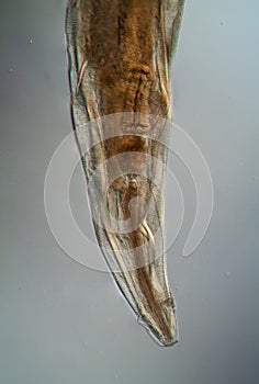 Oxiuris parasitic pinworm 100x