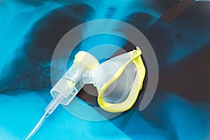 Oxygen mask over the chest x-ray films. Covid-19 outbreak and pneumonia