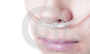 Oxygen tube on the face of a critically ill patient photo