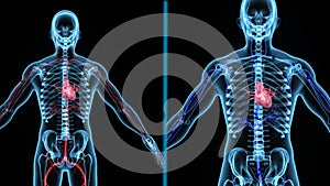 OXYGENATED AND DEOXYGENATED BLOOD