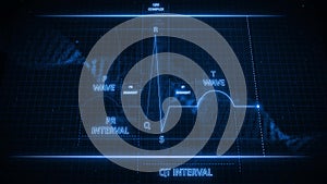 P Wave from Electrocardiogram Wave or ECG or EKG