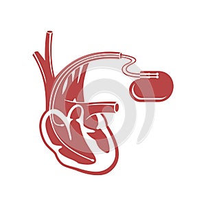 Pacemaker cardio stimulator flat icon photo
