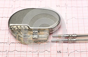 Pacemaker on electrocardiograph
