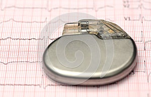 Pacemaker on electrocardiograph photo