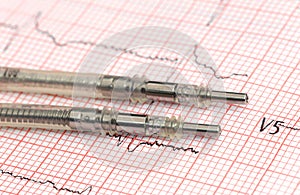 Pacemaker leads on electrocardiograph