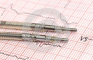 Pacemaker leads on electrocardiograph photo