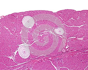 Pacinian corpuscle. Cat pancreas photo