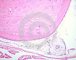 Paciniâ€™s corpuscle. Periostium