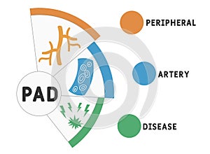 PAD - Peripheral Artery Disease. acronym, medical concept background.