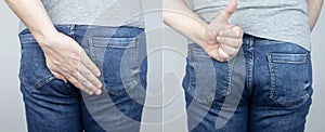 Before and after pain in ass. Conceptual shot of anal problems. On left, the man grabbed his butt in pain, and on the right,