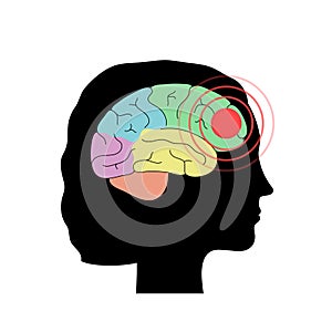 Pain Brain Illustration