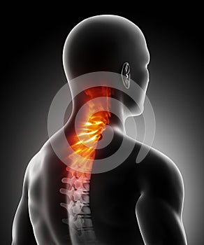 Pain in cervical spine