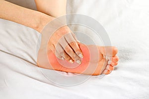 Pain in the foot sole. Bad leg. The focus of pain is marked in r