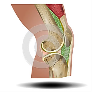 Pain, Injury and Inflammation, Knee Joint Pain Silhouette Icon Ache of Knee, Leg Skeleton, Arthritis, Osteoporosis and Bones Joint