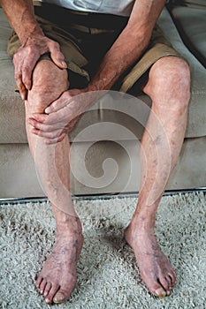 Pain in the legs and knees of an elderly senior