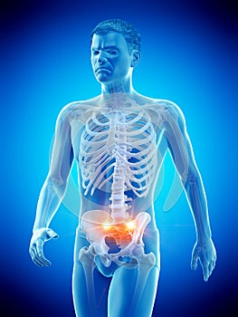 pain in the sacroiliac joint