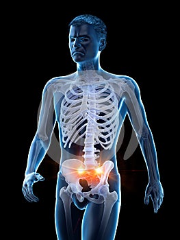 Pain in the sacroiliac joint