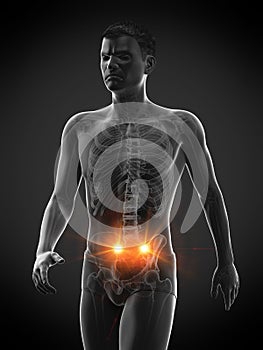 Pain in the sacroiliac joint