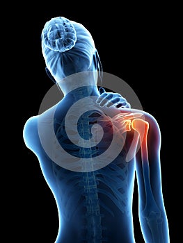 Pain in the shoulder joint