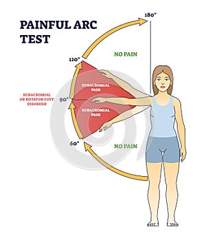 Painful arc test and physiopedia syndrome medical diagnosis outline diagram