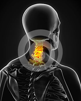 Painful Cervical Spine