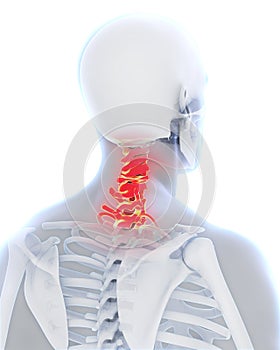 Painful Cervical Spine