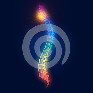 Painful cervical spine, medically 3D illustration
