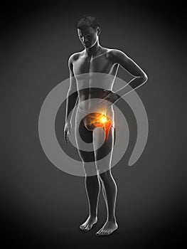 A painful hip joint