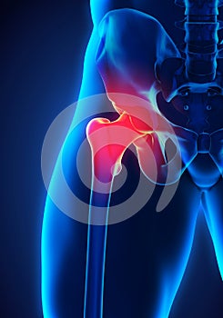 Painful Hip Joint