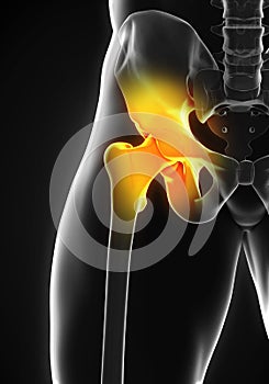 Painful Hip Joint