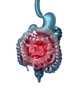 Painful Intestine Anatomy