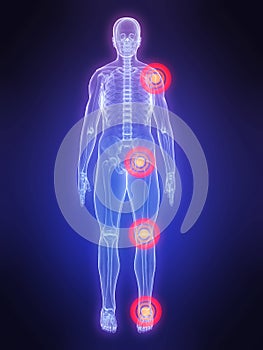 Painful joints photo