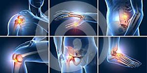 Painful joints, medical 3D illustration